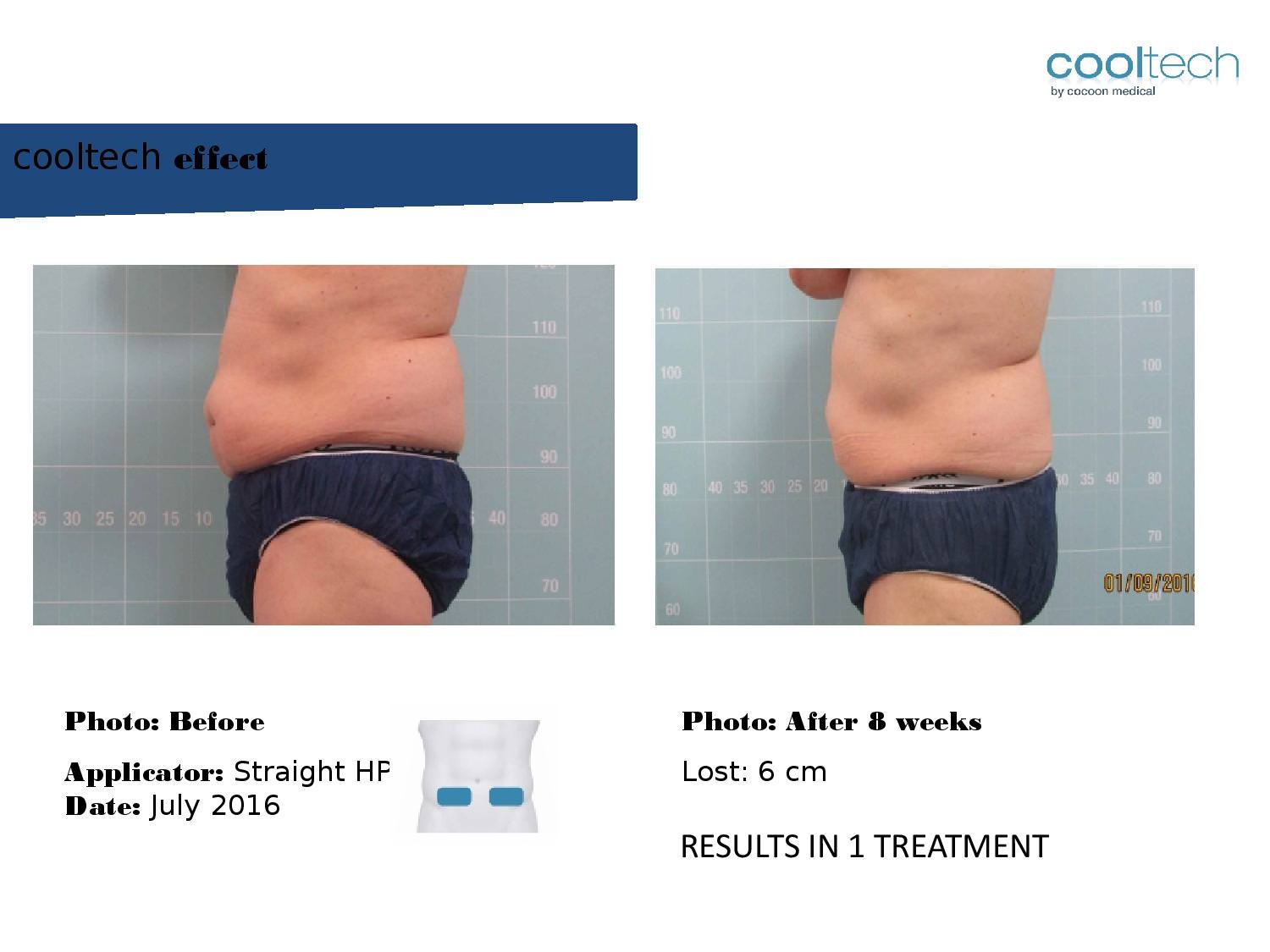 Presentation Cooltech ENG Wigmore Days Novaaaa1-page-003